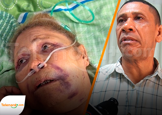 Familiares claman justicia tras brutal agresión contra anciana de 80 años en SFM