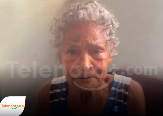 Mujer denuncia hermano le lanzó café caliente en SFM